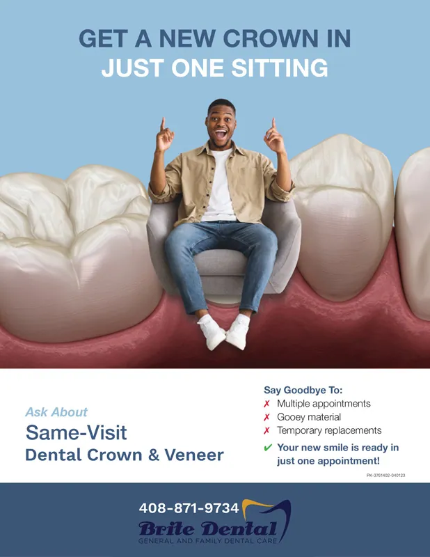 Same Day Crowns